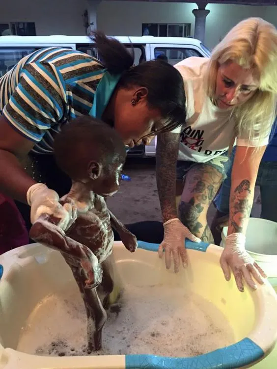 Cậu bé hai tuổi bị bỏ đói suýt chết vì nghi là phù thủy ảnh 4 Cậu bé hai tuổi bị bỏ đói suýt chết vì nghi là phù thủy ảnh 4