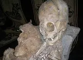 Bí ẩn xác ướp có 3 ngón tay nghi người ngoài hành tinh ảnh 4 Phát hiện hộp sọ của người ngoài hành tinh?