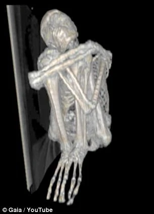 Bí ẩn xác ướp có 3 ngón tay nghi người ngoài hành tinh ảnh 2