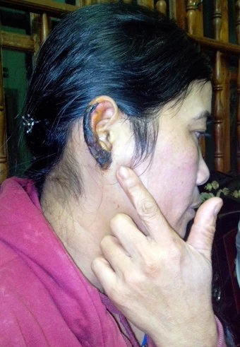 Chị chồng cắn nát tai em dâu ảnh 1