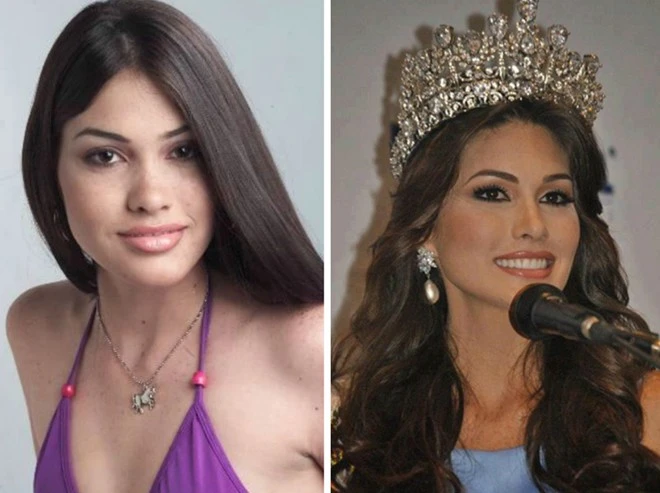 So với bức ảnh trước đây (bên trái), đương kim Hoa hậu Hoàn vũ Gabriela Isler đã thay đổi khá nhiều. Nhan sắc hiện tại của cô bị nhận xét quá sắc, không được tự nhiên như trước.