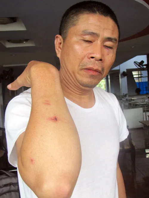 Kéo côn đồ chặn xe khách, đánh người ảnh 1