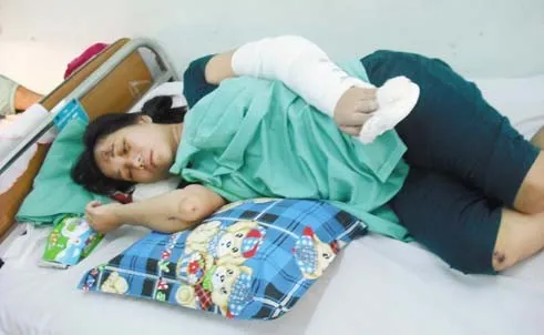 Chị Hà với những vết thương sau khi bị chém.