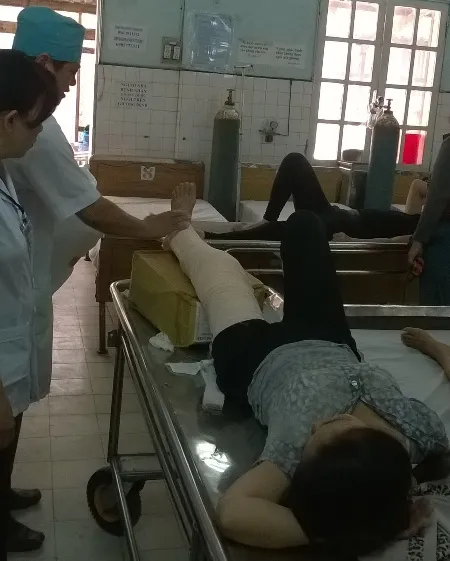 Chị Huệ bị cây phường đè gãy chân