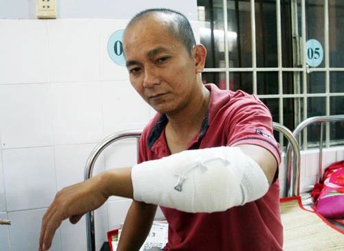 Anh Hải bị chém hai nhát ở tay trái. Ảnh: An Nhơn