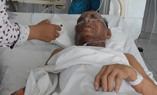 Ông Võ Văn Bời bị bỏng đến 65% đang nằm điều trị tại bệnh viện. Nhập mô tả cho ảnh