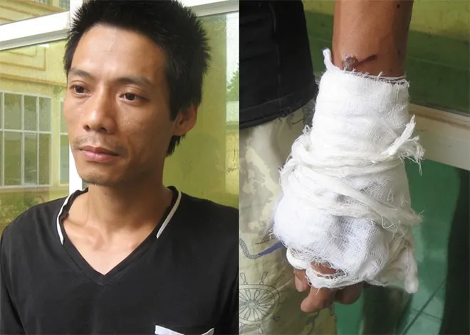 Việc hủy hoại nhan sắc vợ cũng làm Danh gặp thương tích ở cánh tay trái. Ảnh:Việt Đức. N