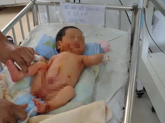 Cháu bé bị bỏ rơi đang được cấp cứu tại bệnh viện. Bé gái sơ sinh bị bỏ rơi ở bụi tre, trên người bám đầy dòi