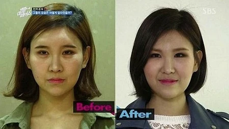 Hàn Quốc được biết tới là quốc gia có số người thực hiện phẫu thuật thẩm mỹ cao nhất thế giới.