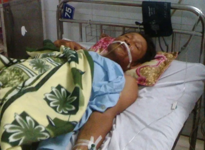 Sau ba ngày điều trị, ông Trình đã qua cơn nguy kịch nhưng vẫn rất yếu.Ảnh: Duy Cảnh Sau ba ngày điều trị, ông Trình đã qua cơn nguy kịch nhưng vẫn rất yếu.