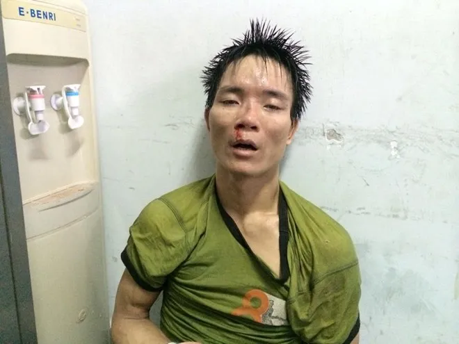 Hảo từng có một tiền án về tội Tàng trữ trái phép chất ma túy. Hảo từng có một tiền án về tội Tàng trữ trái phép chất ma túy.