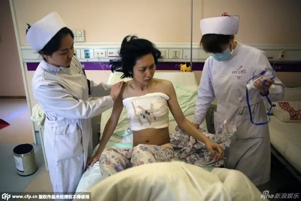 Hình ảnh trên giường phẫu thuật sau ca mổ.