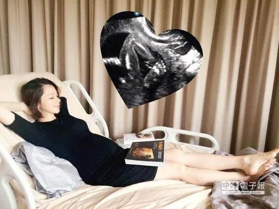 Từ Nhược Tuyên khoe ảnh siêu âm của con trai.