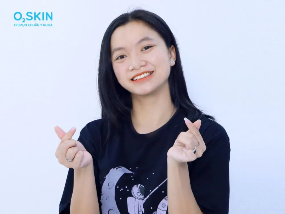 Giờ đây Quỳnh Anh cảm thấy tự tin, vui vẻ và hạnh phúc hơn rất nhiều với vẻ ngoài hiện tại. Kiên trì với phác đồ điều trị mụn trứng cá, nữ sinh nhận 'trái ngọt' sau 3 tháng.png