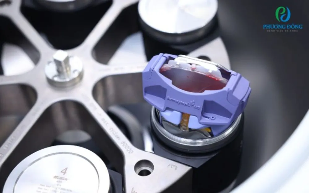 Bảo vệ con yêu với lưu trữ tế bào gốc máu cuống rốn.jpg