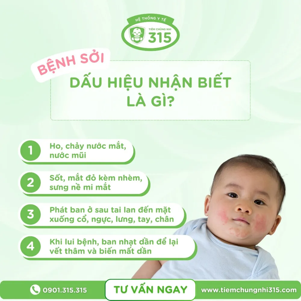 Những dấu hiệu nhận biết trẻ mắc bệnh sởi. can-than-nhung-benh-chi-mac-duy-nhat-mot-lan-trong-doi-2.jpg