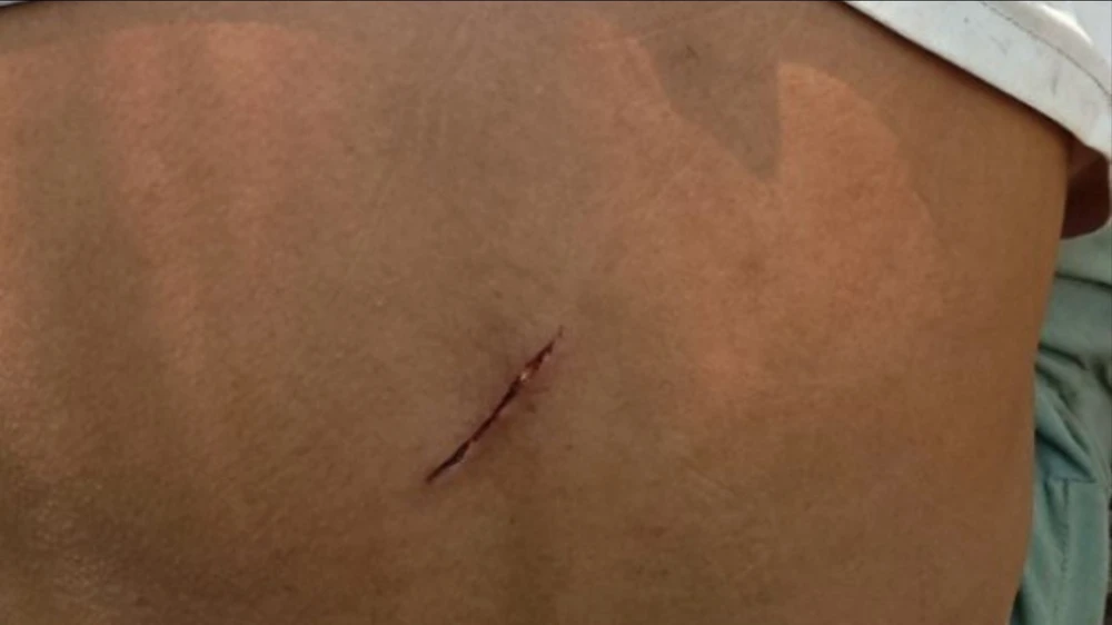 ca-the-vooc-den-gay-trang-tan-cong-nguoi-dan-o-quang-tri (1).jpg