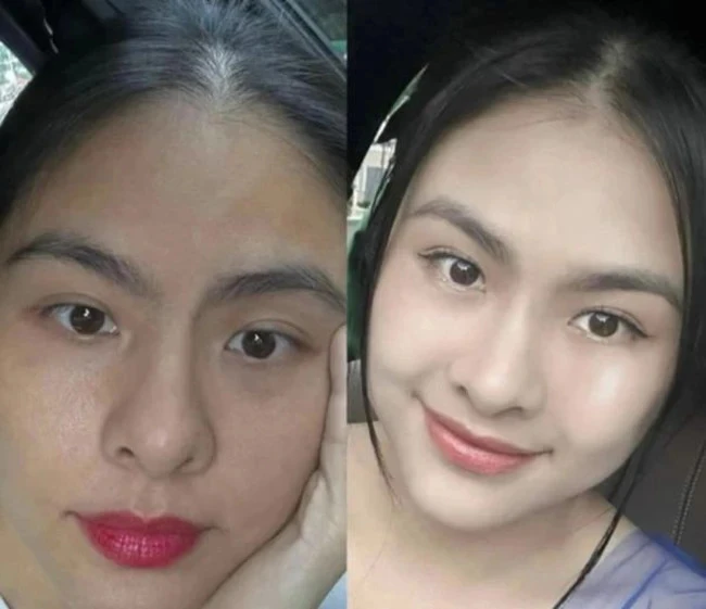 Cụ thể, Vân Trang đăng 2 tấm ảnh cận mặt. Trong một tấm ảnh, da cô tối màu, thâm sạm còn tấm bên cạnh sáng bóng. Ảnh: FBNV Vân Trang