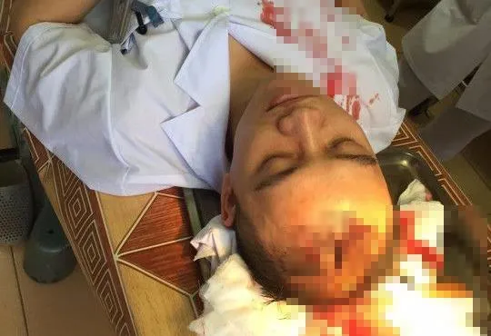 Bác sĩ D. bị người nhà hành hung phải cấp cứu ở Thạch Thất, Hà Nội.