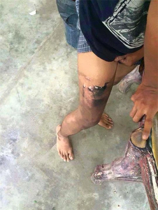 iPhone phát nổ vì trời quá nóng ảnh 2