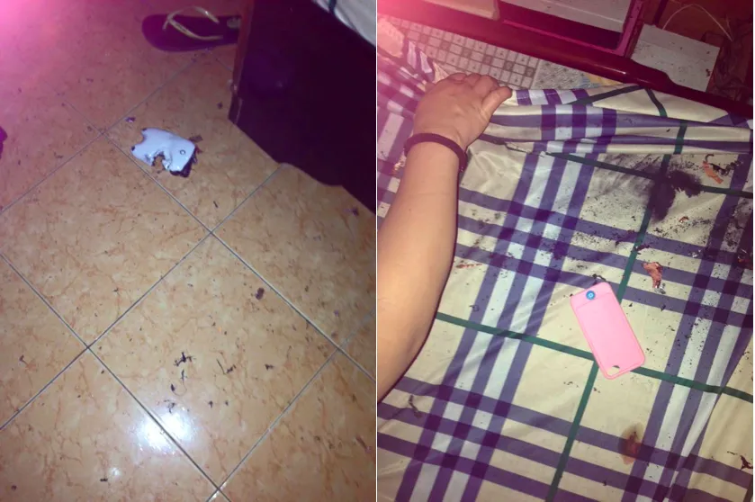 Pin dự phòng phát nổ, một cô gái tại Đà Nẵng thoát chết ảnh 2 Pin dự phòng phát nổ, một cô gái tại Đà Nẵng thoát chết ảnh 2