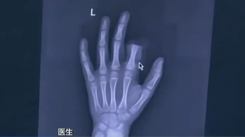 tu-cat-ngon-tay-vi-bi-cam-xai-smartphone