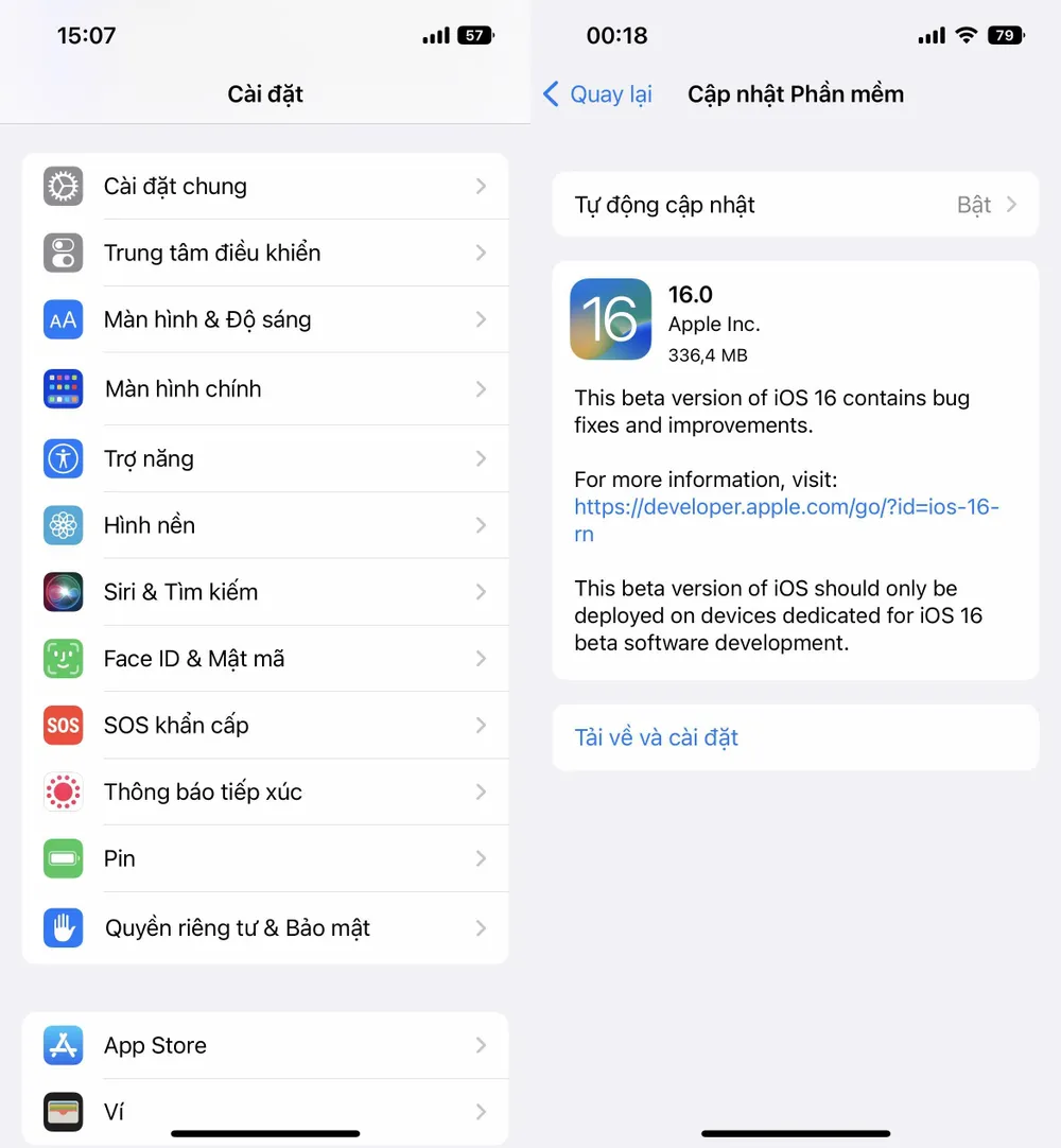Cập nhật iOS lên phiên bản mới nhất. Ảnh: TIỂU MINH