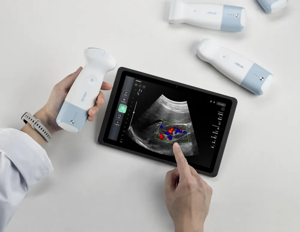 Tin công nghệ 2-6: Máy siêu âm cầm tay của ASUS.