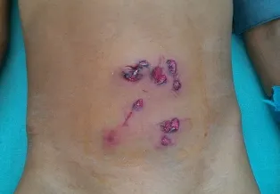 Súng cướp cò, một bé trai dính 10 viên đạn vào bụng ảnh 1