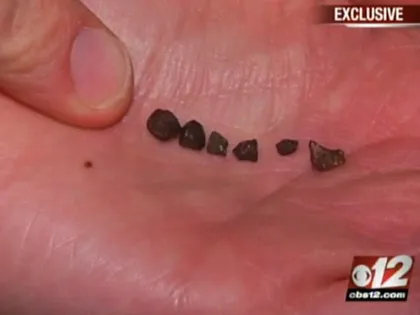 Thiên thạch rơi trúng đầu bé trai 7 tuổi ảnh 2 Thiên thạch rơi trúng đầu bé trai 7 tuổi ảnh 2