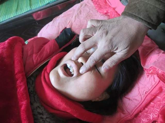 Phó trưởng Công an vô cớ đánh dân nhập viện ảnh 1