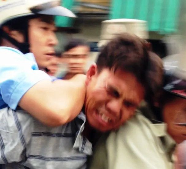 Trật tự đô thị đánh ngất xỉu người bán hàng rong ảnh 1