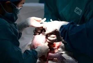 Mổ lấy thai trên 15% nhiều tai biến hơn cho mẹ và con ảnh 1