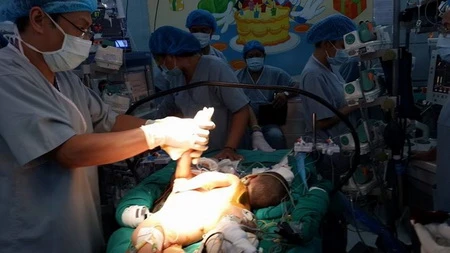 Ca phẩu thuật tách rời cặp song sinh ảnh 3