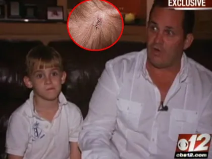 Thiên thạch rơi trúng đầu bé trai 7 tuổi ảnh 1 Thiên thạch rơi trúng đầu bé trai 7 tuổi ảnh 1