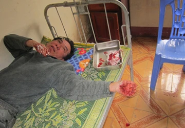 Một tổng biên tập trình báo bị đánh trọng thương ảnh 2