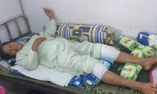 Đau chân trái, bác sĩ mổ... chân phải ảnh 1 Đau chân trái, bác sĩ mổ... chân phải ảnh 1