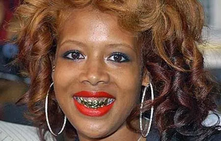 Điểm mặt những người nổi tiếng xấu nhất thế giới ảnh 10 Điểm mặt những người nổi tiếng xấu nhất thế giới ảnh 10