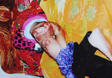 Điều tra vụ người giúp việc bị tra tấn ảnh 1 Điều tra vụ người giúp việc bị tra tấn ảnh 1