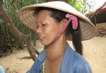 Bệnh tự miễn: “Nội chiến” trong cơ thể ảnh 1