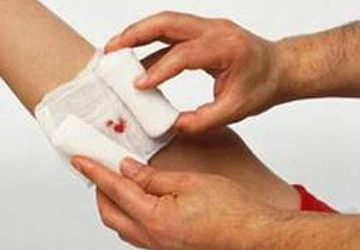 Để không bị hoại tử chi, cần garo và băng ép đúng cách ảnh 1