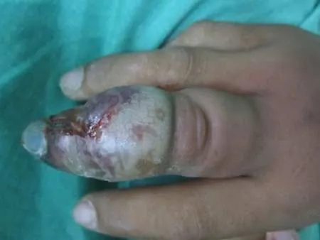 Tử vong vì heo cắn ảnh 1