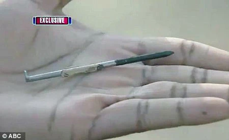 Đinh 10cm cắm vào tim, vẫn sống sót kỳ diệu ảnh 3 Đinh 10cm cắm vào tim, vẫn sống sót kỳ diệu ảnh 3