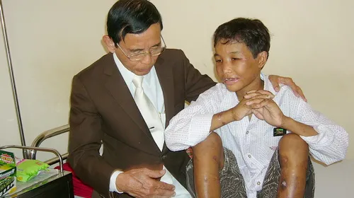 Bé Hào Anh đã tăng 4,5kg ảnh 1 Bé Hào Anh đã tăng 4,5kg ảnh 1