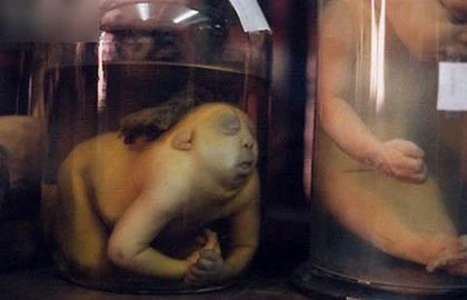 Bảo tàng rùng rợn nhất thế giới ảnh 5