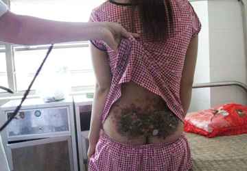 Không chịu lấy chồng, bị đánh dã man ảnh 1