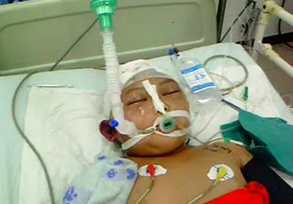 Bé trai 5 tuổi bị đánh đập dã man, hôn mê suốt 10 ngày chưa tỉnh ảnh 1