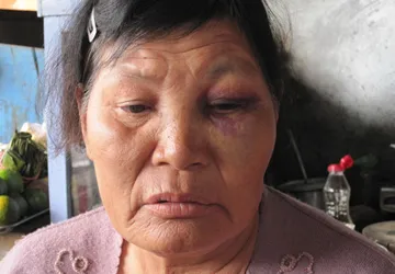 Con trai đánh mẹ bầm dập vì muốn chiếm nhà ảnh 1 Con trai đánh mẹ bầm dập vì muốn chiếm nhà ảnh 1