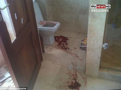 Lộ ảnh đẫm máu trong nhà Pistorius ảnh 1