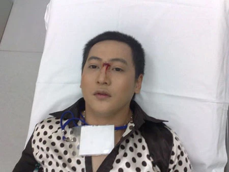 Diễn viên Phi Long bị chấn thương khi quay phim ảnh 1